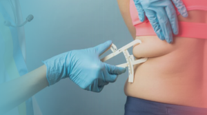 liposuction surgery